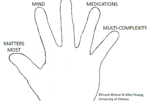 5 Fingers 1