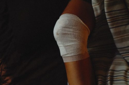 Living With CRPS