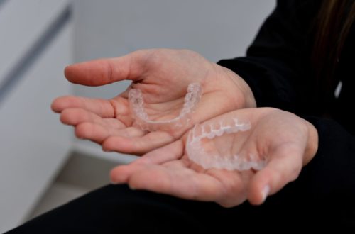 Accelerate Clear Aligner Treatment