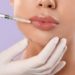 Hyaluronic Acid Lip Fillers